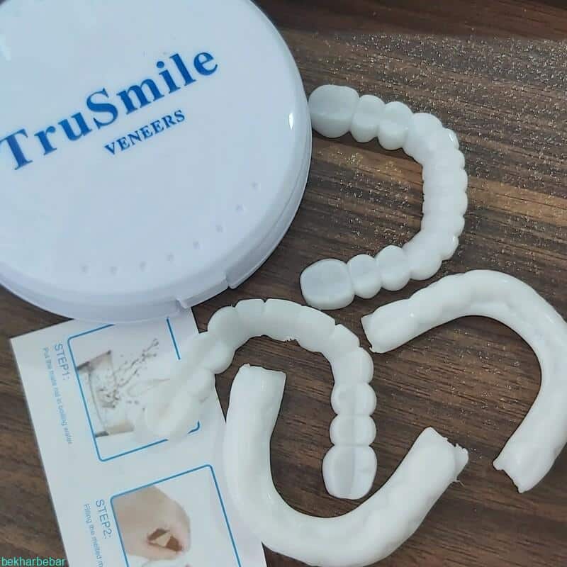 لمینت متحرک دندان 