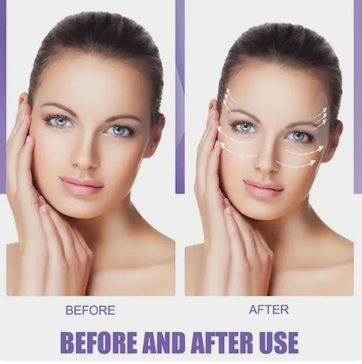 چسب لیفتینگ دور چشم